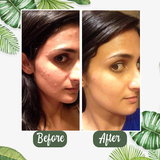Green Tea Nourishing Clay Stick Mask | Deep Pore Cleansing, Hydrating & Gentle Exfoliation (40g)