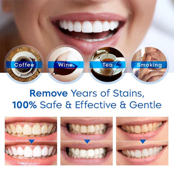 Teeth Whitening Pen | Gentle Stain Remover & Enamel-Safe Brightening Formula | Portable Instant White Smile (4ml)