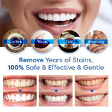 Teeth Whitening Pen | Gentle Stain Remover & Enamel-Safe Brightening Formula | Portable Instant White Smile (4ml)